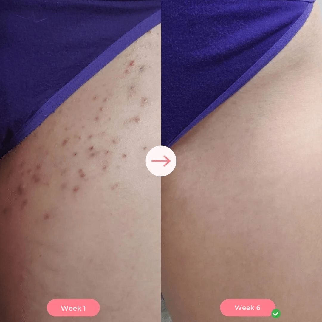 SUPPLY IPL PRO™